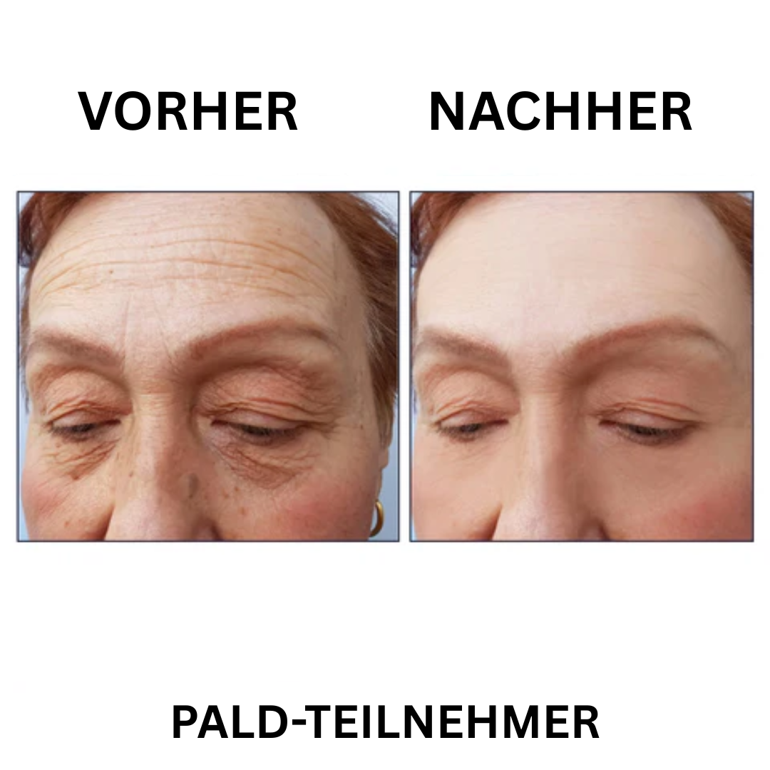 Falten Fix
