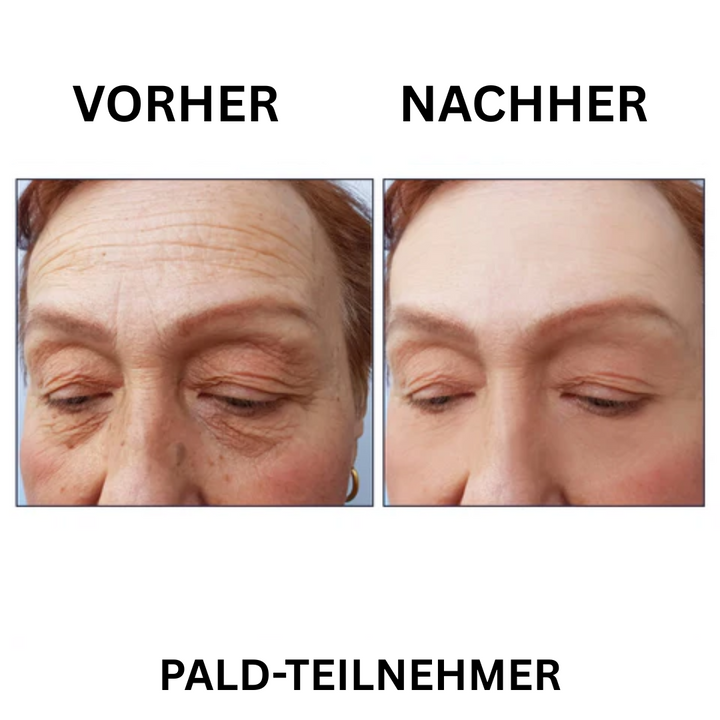 Falten Fix