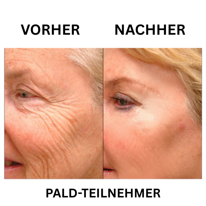 Falten Fix