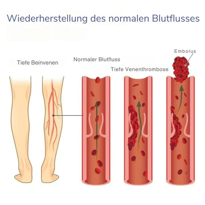 Selbstheizendes Knieband: Schnelle Schmerzlinderung