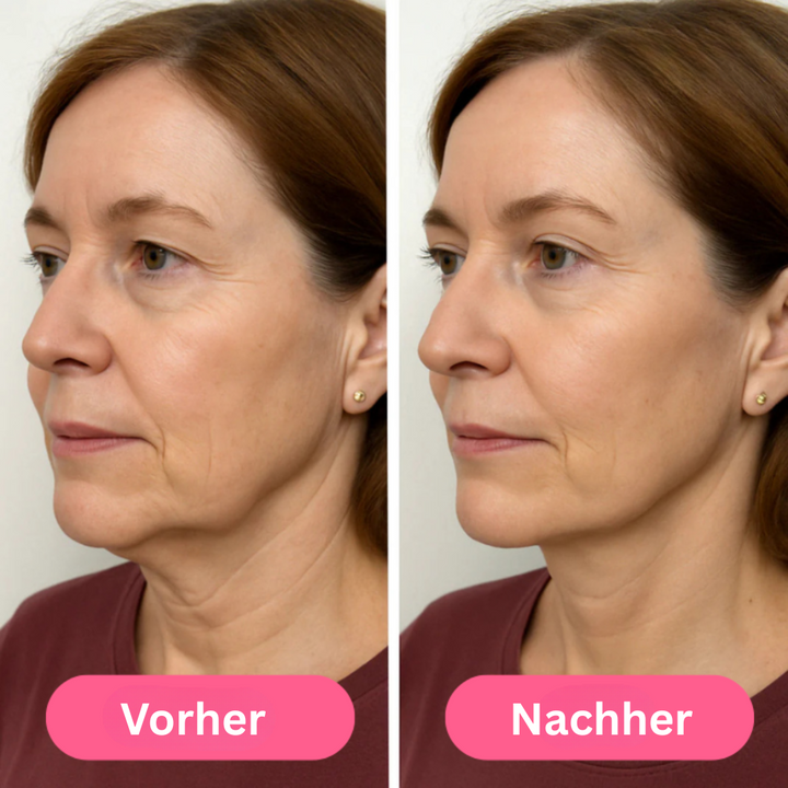 LumiRoll | Strahlenroller